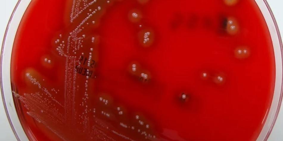 Aumento de casos de Streptococcus pyogenes en Argentina. Recomendaciones para la prevención de la enfermedad